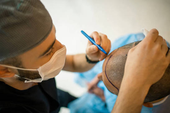 Top Hair Transplant Surgeon in Tardeo,South Mumbai